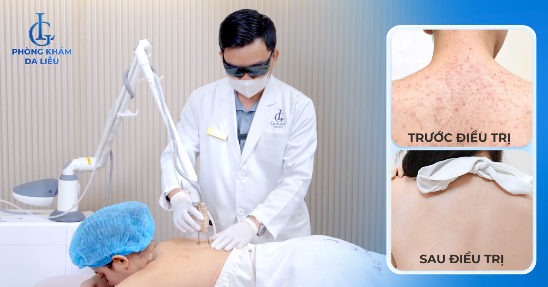 Viêm nang lông lưng – tình trạng da lưng sần sùi, thâm đỏ thường gặp